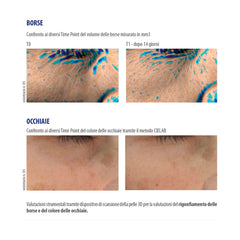 Ireos Siero Gel Liftante Illuminante Antiborse Antiocchiaie